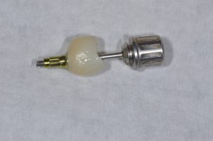 dental implant screw crown