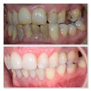 improving dental health infinity dental clinic leeds