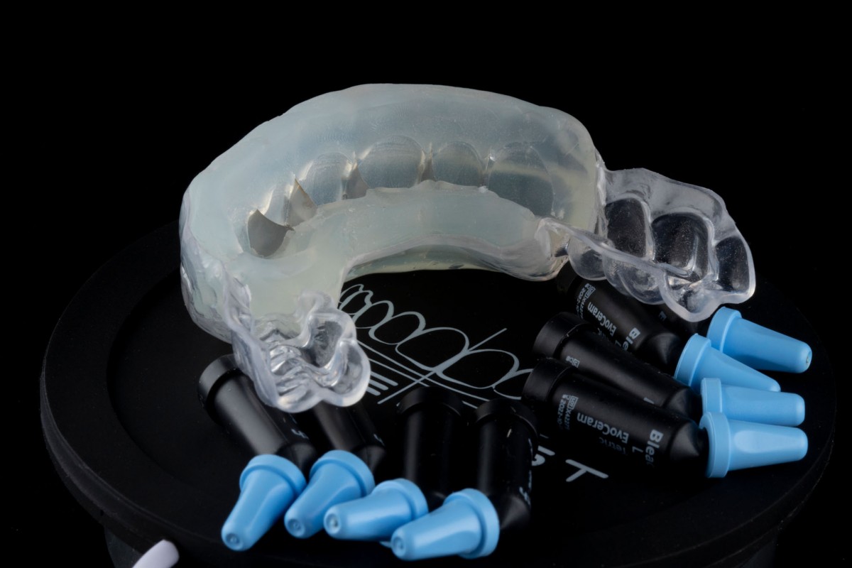 smilefast stent Infinity Dental Clinic