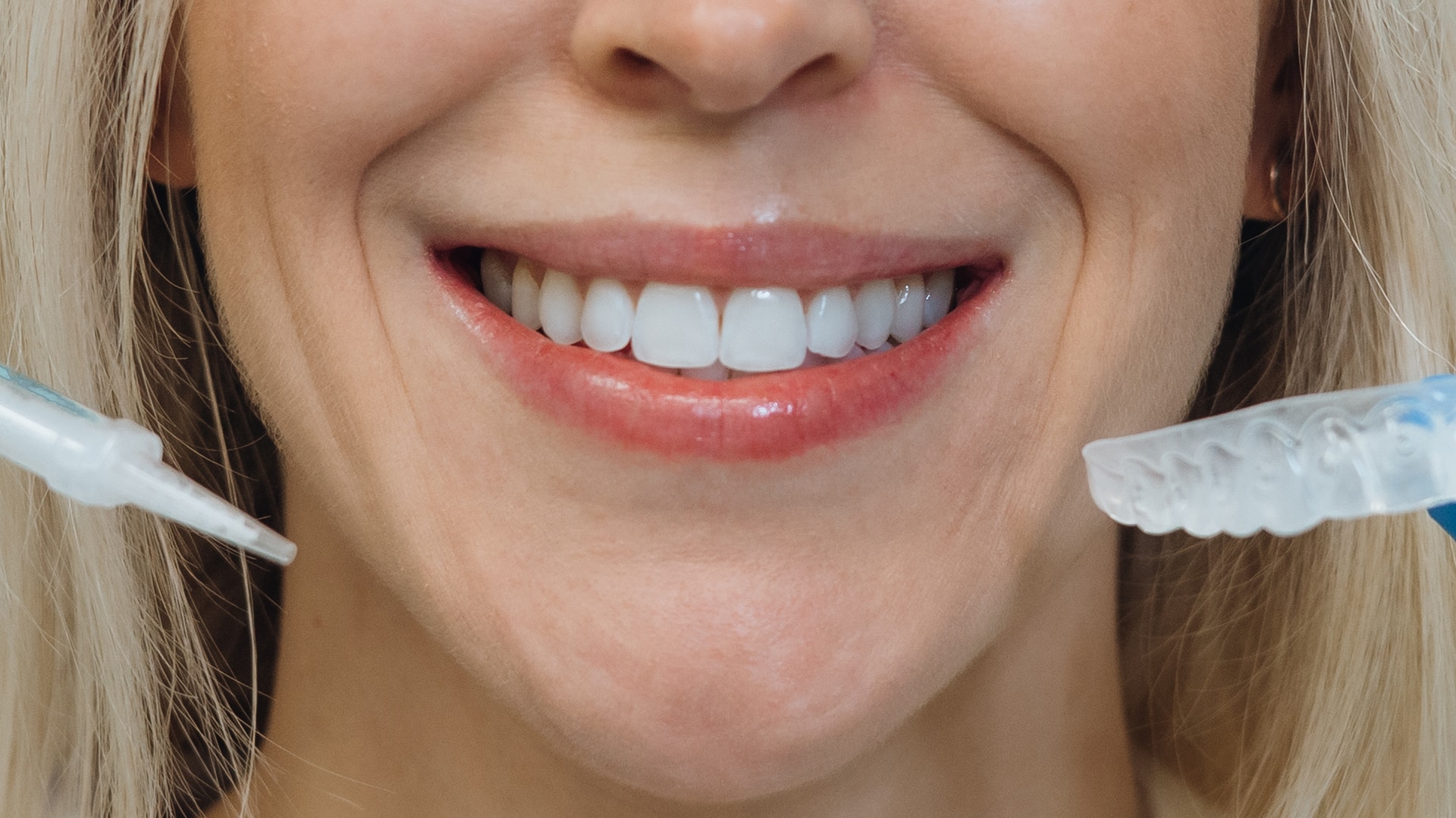 Cosmetic dentistry teeth whitening