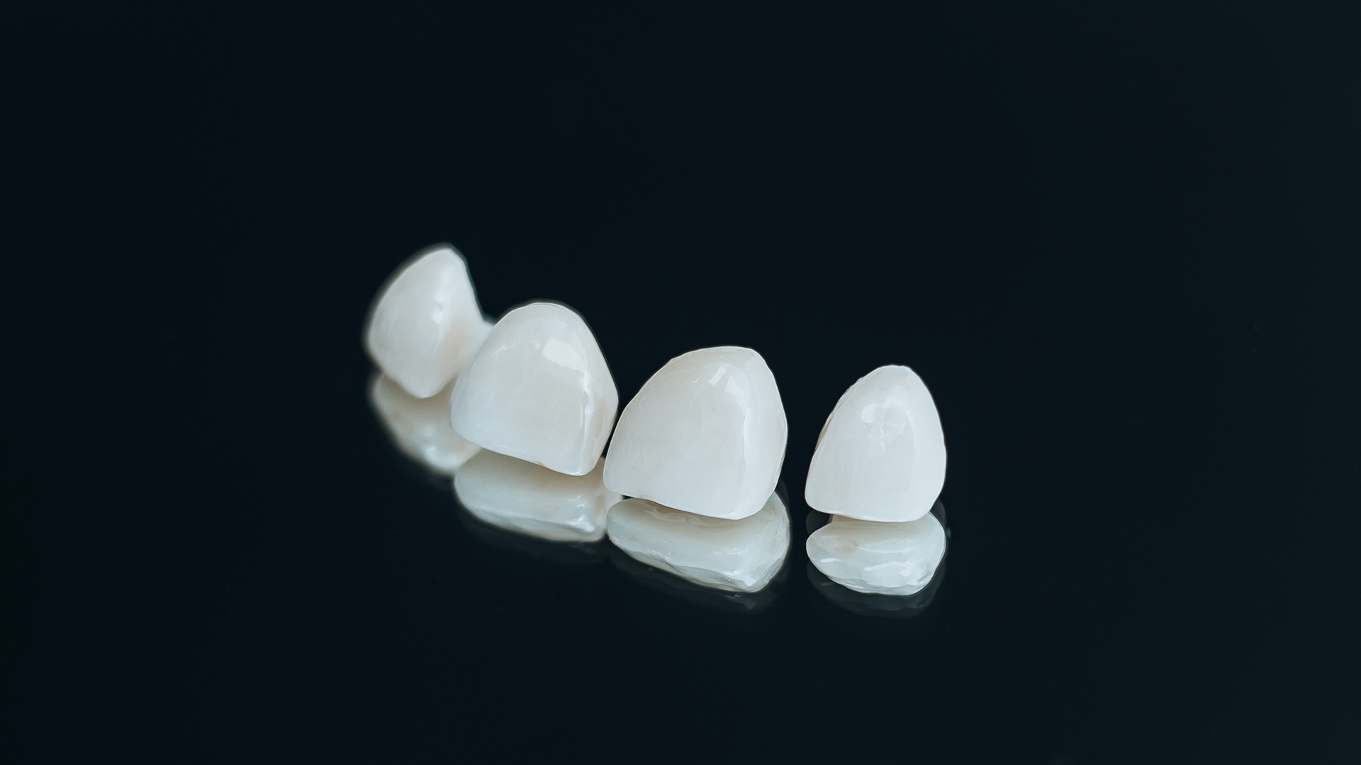 Dental Veneers Infinity Dental Clinic Leeds Cosmetic