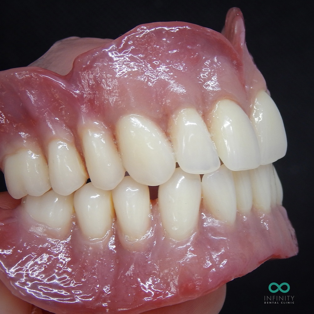 Valplast dentures