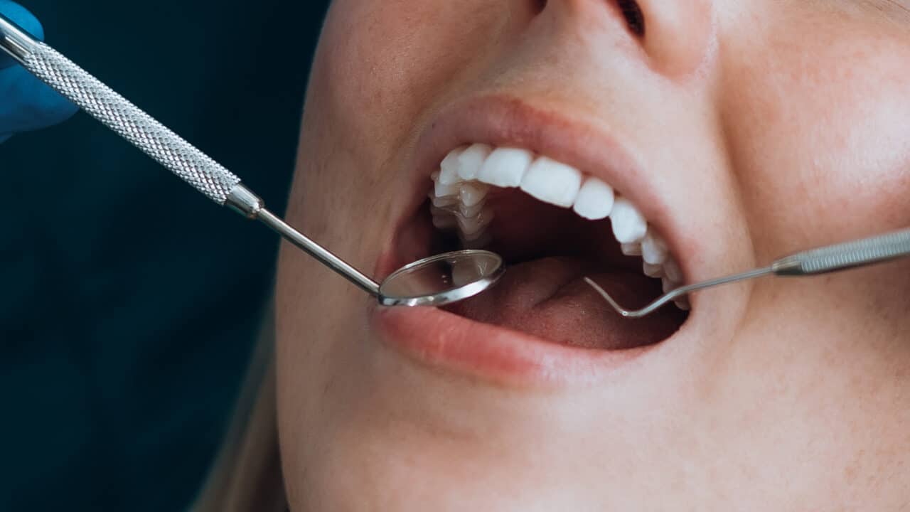 Dental instruments in an open mouth at Infinity Dental Clinic