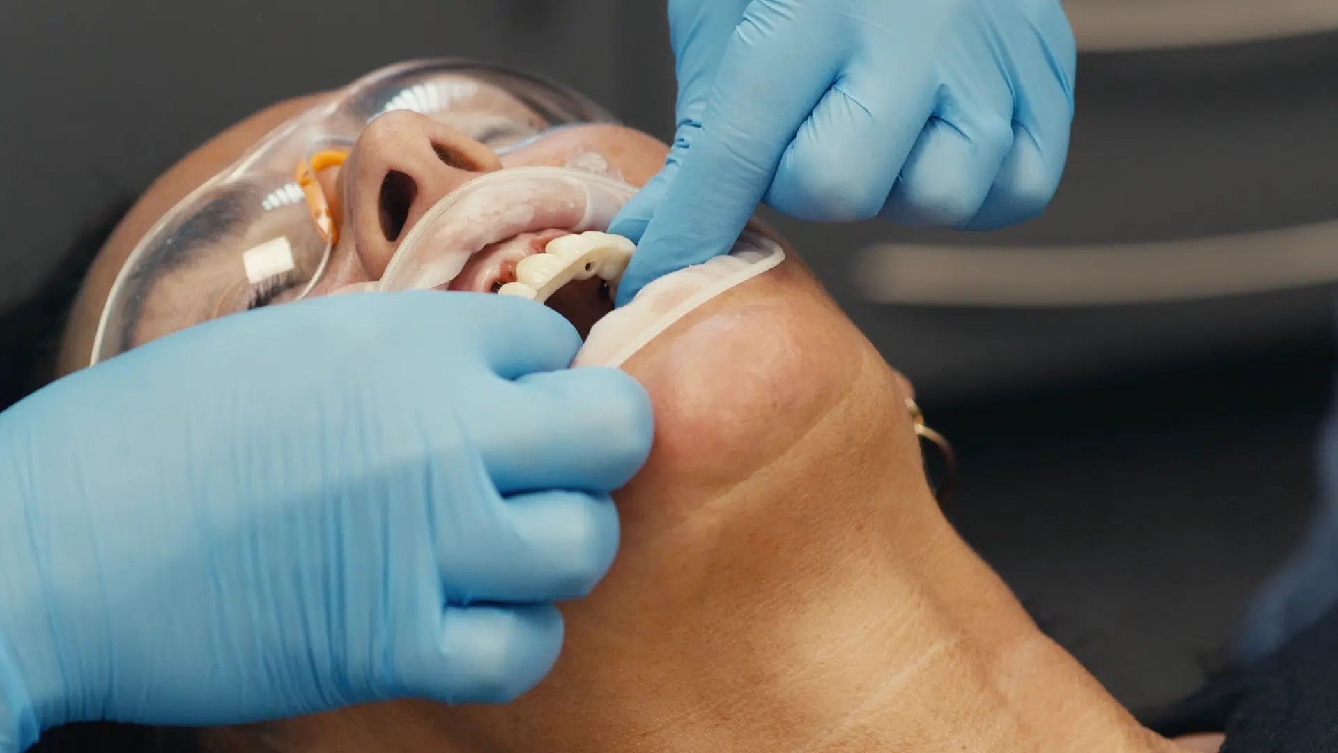 Dental Implants Leeds