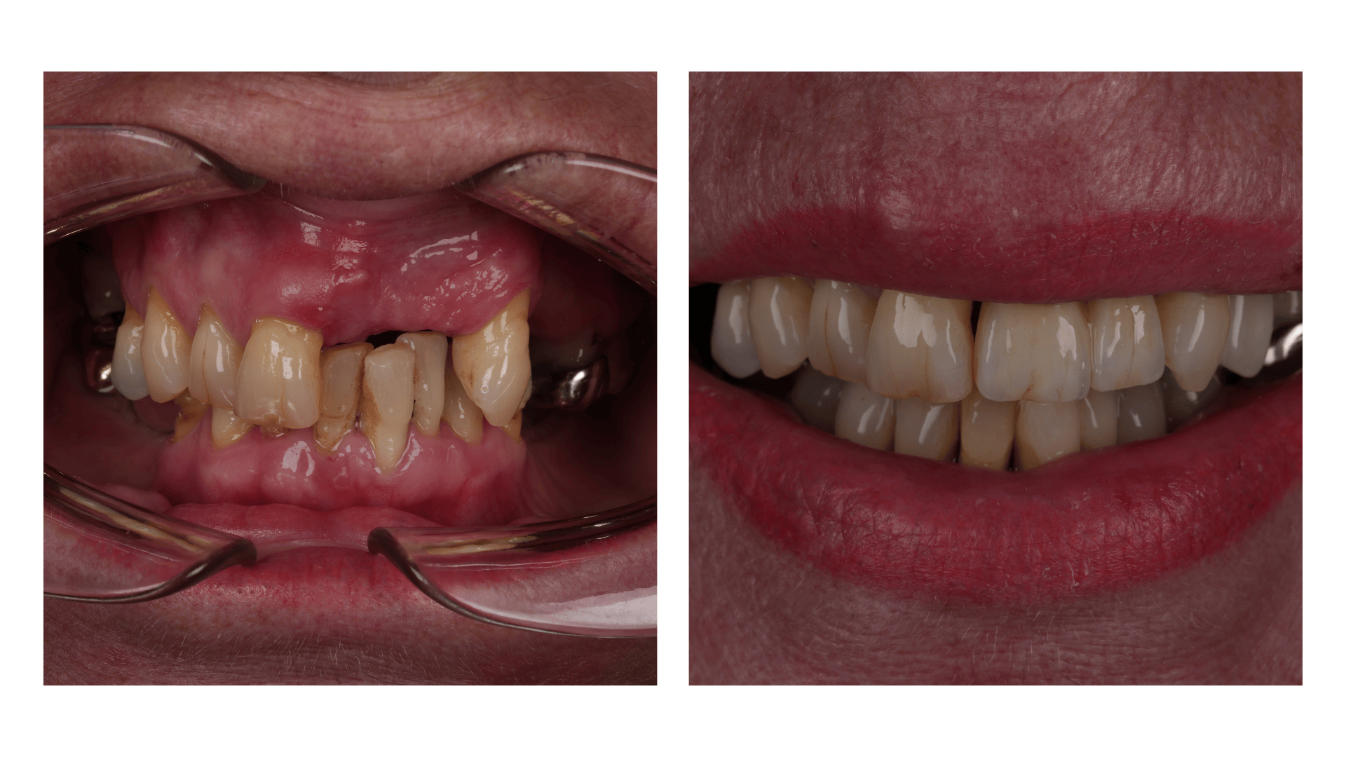 Infinity Dental Clinic Harrogate