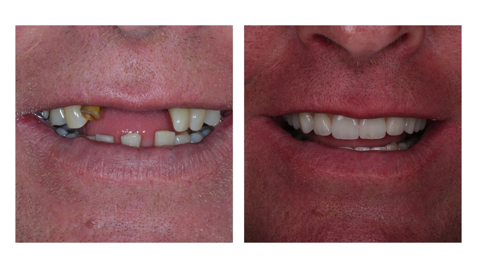 Infinity Dental Clinic Harrogate