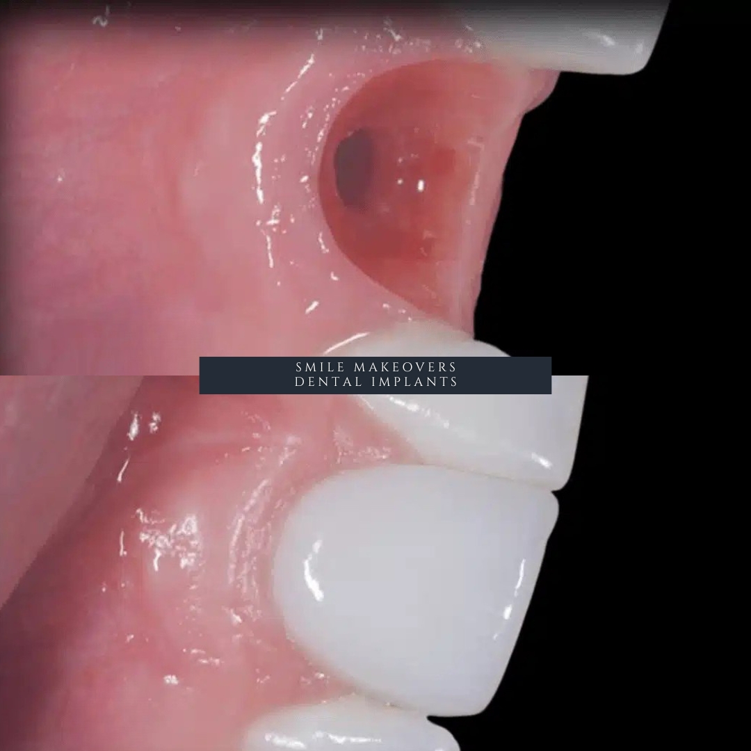 exterior view of Infinity Dental Clinic Leeds and Harrogate dental implant practice