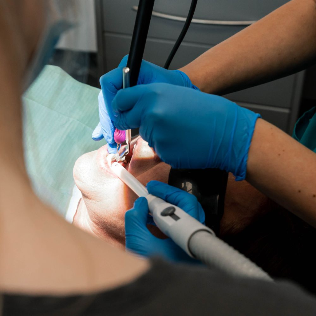 Full Arch Dental Implants Leeds and Harrogate Dentist performing root canal treatment at Infinity Dental Clinic showing typical procedure length