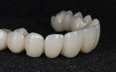 Close up of fixed dental implant teeth showing natural shape and colour matching