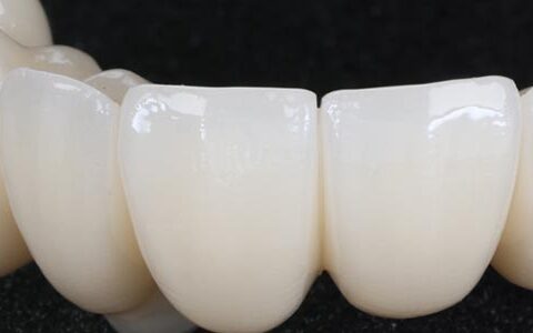 dental implants leeds harrogate