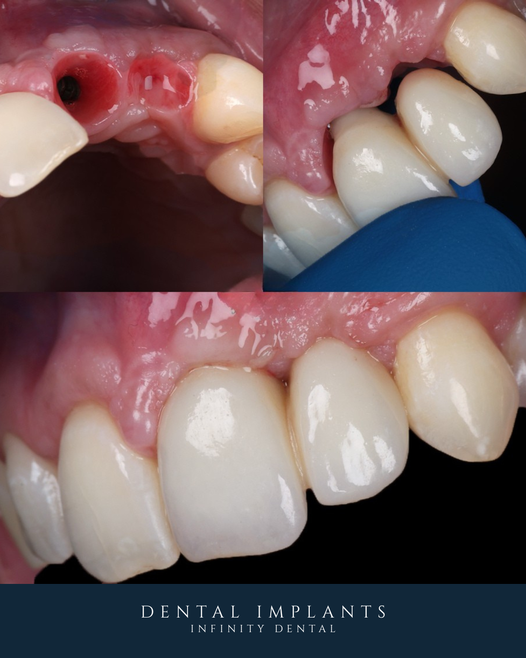 portrait of Dr Mohsin Patel UK’s leading Straumann dental implant surgeon Leeds and Harrogate